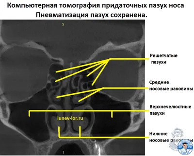 КТ пазух носа от 3000 рублей в СПб