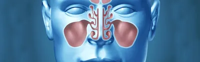 МРТ придаточных пазух носа - «Томография на Семашко»