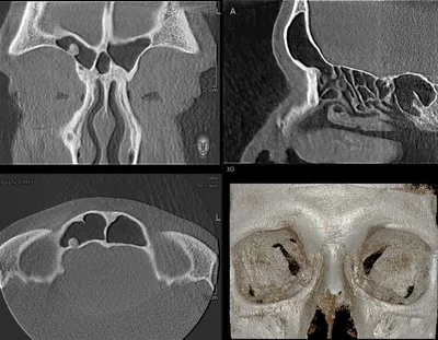 КТ пазух носа от 3000 рублей в СПб