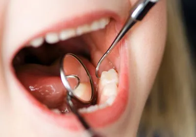 Страдания человека от зубной боли на фоне серого цвета Стоковое Фото -  изображение насчитывающей плохой, ушиб: 183153462