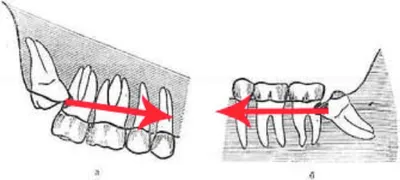 Ответ пользователю @Paster как избавиться от зубной боли?!#лайфхак #зд... |  TikTok