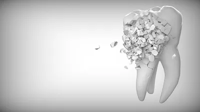 Зубы мудрости - нарушение прикуса и прорезывание восмерок - удалять их или  нет?