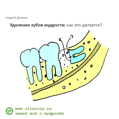 Средства от зубной боли при беременности | стоматологическая клиника  СолоДент