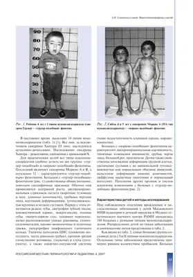 DocDeti детская клиника доказательной медицины - Гипотония Рассказывает  невролог DocDeti Ольга Шемятовская @doctor_shemyatovskaya Это один из  диагнозов, заставляющих родителей волноваться, а детей страдать. Признаки  реального гипотонуса (гипотонии ...