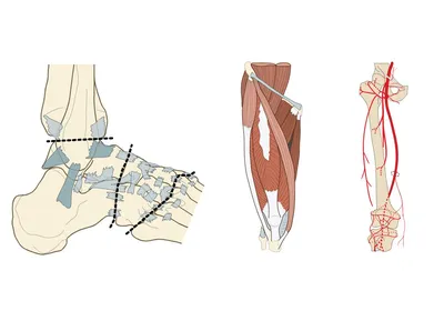 Анатомия нижней конечности | e-Anatomy