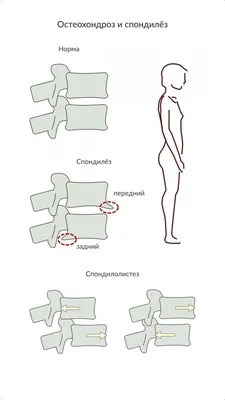 Анатомия нижней конечности | e-Anatomy