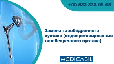 Лечение Повреждение суставной губы - Ортопедия Руслана Сергиенко