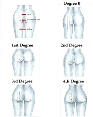 Лошадь - Остеология : нормальная анатомия | vet-Anatomy