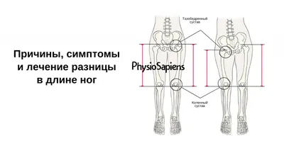 Бедренная кость - Kenhub