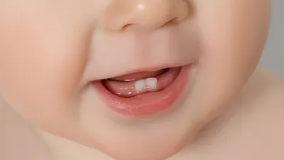 Сколько у детей должно быть в норме молочных зубов