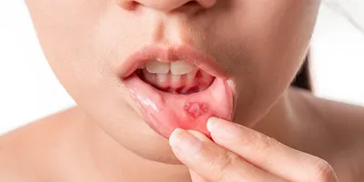 Зубки вашего ребенка: все, что должны знать родители