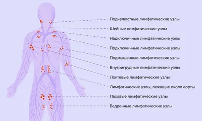 Онкологи - 🔔В клинику поступает пациент 22 лет с жалобами на одышку,  повышение t тела до 38С, ночную потливость, кожный зуд. При рентгенографии  органов грудной клетки – расширение тени средостения до 10