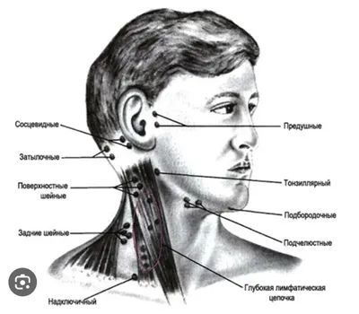 Увеличение лимфоузлов. Когда это опасно, а когда нет | Хворь не помеха |  Дзен