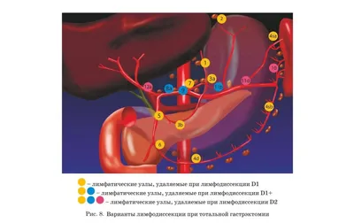 Онко Вики — Как устроены легкие?