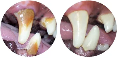 Гингивит у собак: причины, симптомы, лечение гингивита у собак | Royal Canin