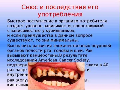 Не вздумай употреблять Насвай!!! Ты будешь в шоке, описание, последствия и  признаки зависимости. | \"Вкусно Жить\" | Дзен
