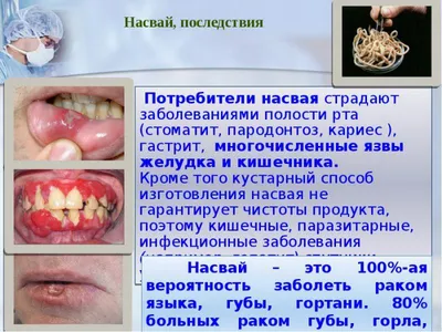 Что такое Насвай на самом деле и как выглядит наркотик на фото