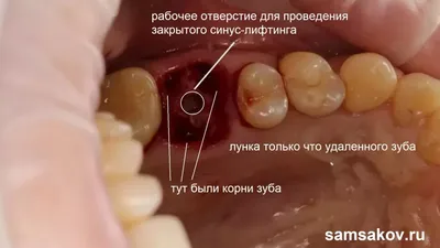 Название зубов фото фотографии