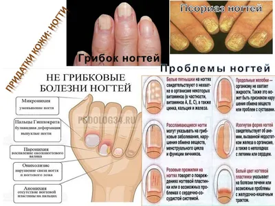 Как выглядят здоровые ногти: 5 основных признаков