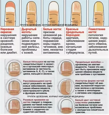 ЛэшмейкерИндастринг - ‼️Девчонки, сегодня хочу Вам немного рассказать о ЗАБОЛЕВАНИЯХ  НОГТЕЙ‼️ Здоровые ногти – это не просто красиво, но и считается признаком  здорового организма. К сожалению, с ногтями возникает все больше проблем,