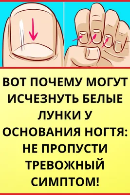 Подолог.Углич. on Instagram: \"Обычно при виде изменений на ногтях рук или  ног первое желание – бежать в аптеку за противогрибковой мазью. 🙄 ⠀ Хотя  причины таких изменений могут быть совершенно разными, более