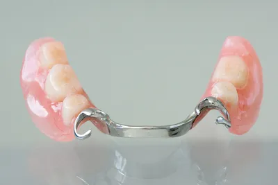 Нейлоновые зубные протезы — недостатки, срок службы, как крепятся на  Startsmile.ru