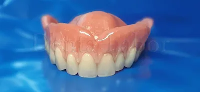 Съемные нейлоновые зубные протезы. Цена в Новосибирске