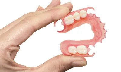 Съемные нейлоновые протезы - Green стоматология