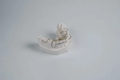 Бюгельный зубной протез на верхнюю челюсть - Центр приватной стоматологии  «Доктор Левин»