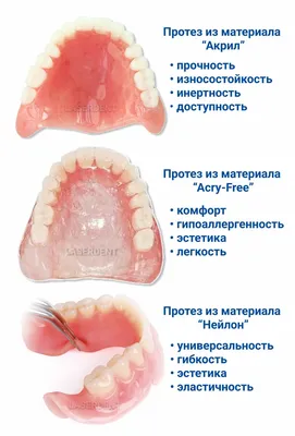 Зубные протезы без неба по доступной цене в стоматологии «Ортодонт-центр»