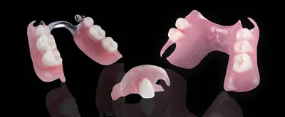 Керамический зубной протез и керамические коронки – преображение улыбки