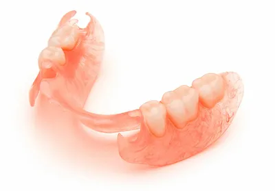 Пациентка Д. – Поставили несъемный зубной протез на верхнюю и нижнюю челюсть