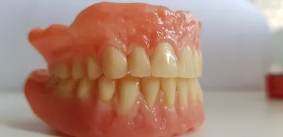 Нейлоновые зубные протезы в Санкт-Петербурге: стоматология «Фактор Улыбки»