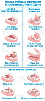 Бюгельный протез на верхнюю и нижнюю челюсть в Гомеле