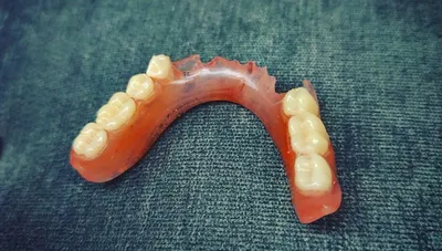 Зубные протезы стучат при жевании
