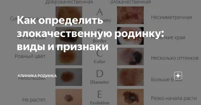 РОДИНКА ХОРОШАЯ И ПЛОХАЯ. Китайское искусство чтения лиц. | Physiognomika |  Дзен