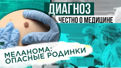 Профилактика кожных патологий — ГБУЗ \"Республиканский онкологический  диспансер\"