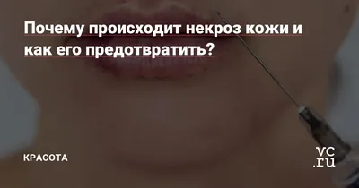 Почему происходит некроз кожи и как его предотвратить? — Красота на vc.ru