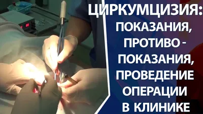 Частичное обрезание: где сделать частичное обрезание в Москве, цены на  платные услуги в клинике