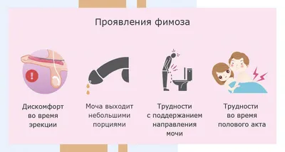 Обрезание крайней плоти в Киеве (циркумцизио) | Цена операции