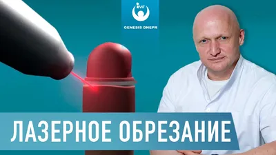 Лазерное обрезание крайней плоти (лазерная циркумцизия) - Terramed