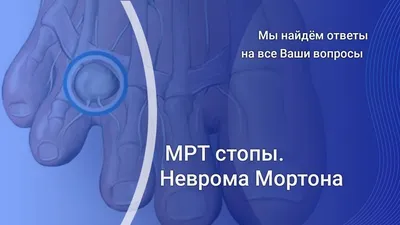 Что такое Неврома Мортона? Как диагностируется? | Ортопед Игорь Пахомов |  Дзен