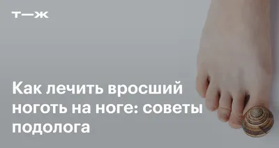 Почему болят ногти на ногах? — болит ноготь на большом пальце ноги, причины  боли и черноты ногтя на ноге