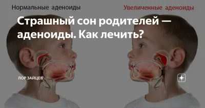 Всемирный день ребенка и педиатра: как лечить аденоиды у детейВсемирный  день ребенка и педиатра: как лечить аденоиды у детей | Медицинский дом Odrex