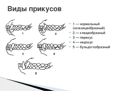 Молочные зубы у щенков - когда у щенков меняются зубы, сколько молочных  зубов у щенков | Pet-Yes