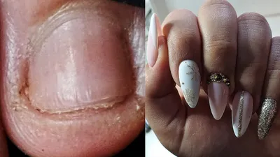 Много лет грызли ногти: как восстановить их у мастера маникюра | Лизи Визи  | Дзен