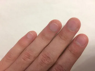 Обгрызенные ногти к девятисотому (60 фото)