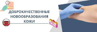 Нейрофиброматоз - причины появления, симптомы заболевания, диагностика и  способы лечения