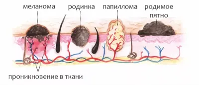 Язвы на коже: симптомы, причины и лечение