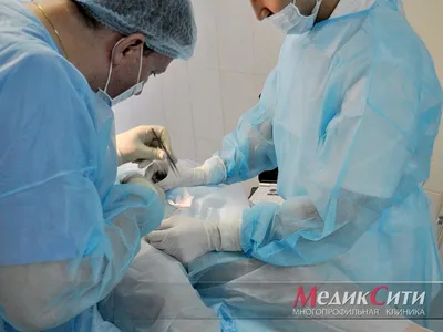 Отзыв после обрезания, 07.07.2018 - Обрезание крайней плоти у мужчин